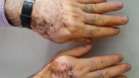 Dokuz Eylül afet bölgesinde salgına karşı teyakkuzda