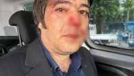 İstanbul Büyükşehir ekiplerine ‘yıkım’ saldırısı… 3 darp, 1 yaralı!